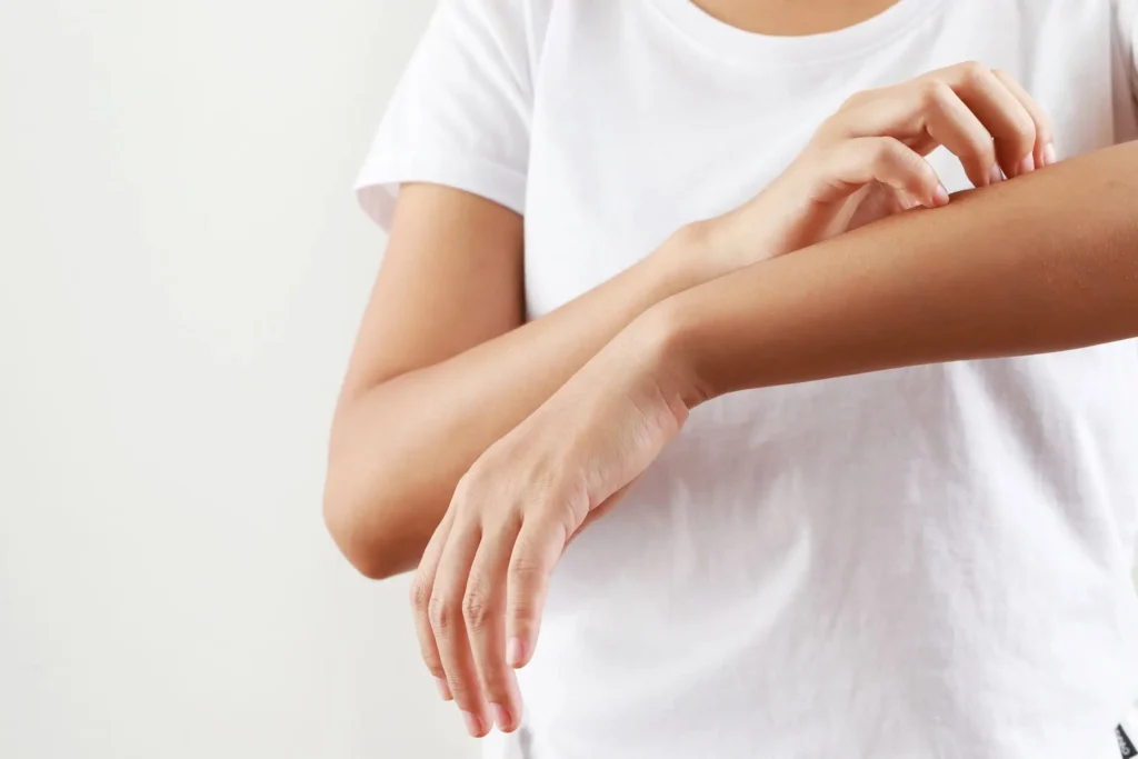 Eczema and Psoriasis Treatment