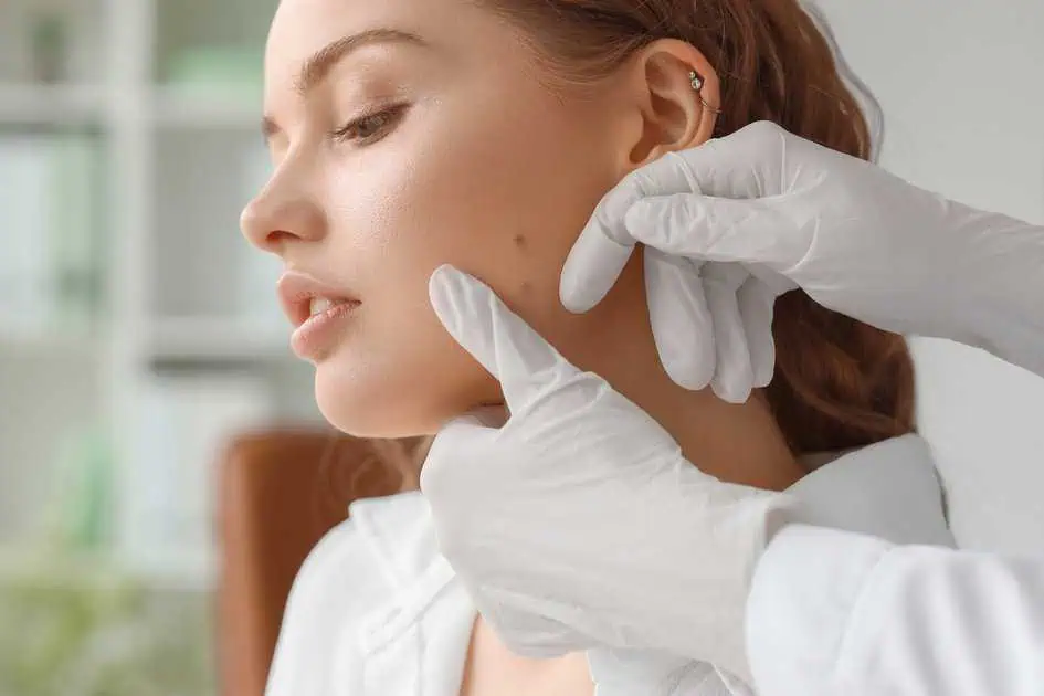 Mole Removal Solutions in Houston, TX by Premier Derm Center