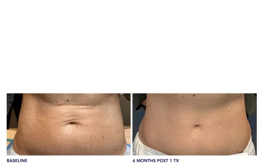 Images Courtesy of Ashley M Lovett, RN