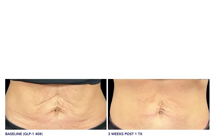 Images Courtesy of Michele Gittings, PA-C