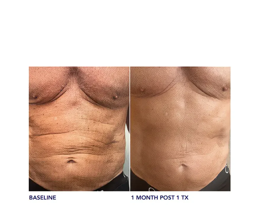 Images Courtesy of Shani Caviness, PA