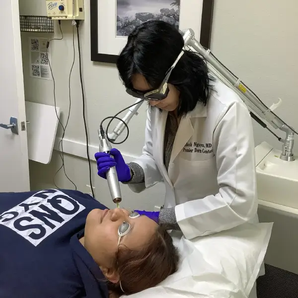 PicoWay Brown Spot Removal